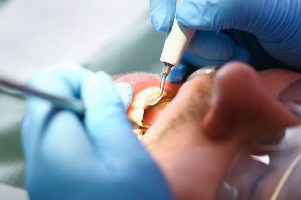 Best Broken or Cracked Tooth Emergency Dentist in Ontario, OH